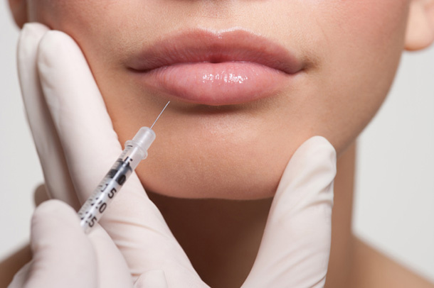 Powiększanie ust kwasem hialuronowym - zalety zabiegu