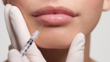 Powiększanie ust kwasem hialuronowym - zalety zabiegu
